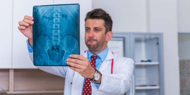 bursita trohanteriana diagnostic, radiografie sold