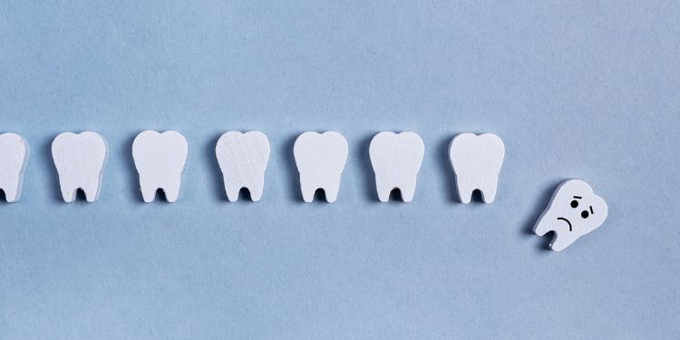 ce sa faceti în caz de traumatism dentar la copii, urgentele dentare la copii,