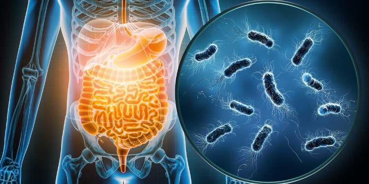 gastroenterite de vara, gastroenterita, cauze ale gastroenteritei, remedii gastroenterita, rehidratare, 
