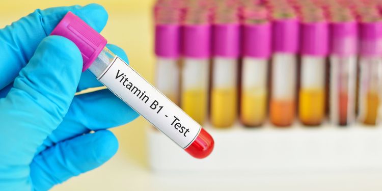 de ce avem nevoie de vitamina B1,