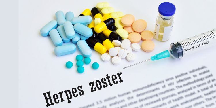 vaccin varicela efecte adverse, zona zoster si vaccinul de varicela, legatura dintre zona zoster si varicela,