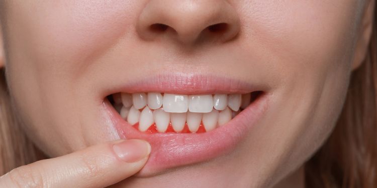 precautii si efecte adverse ale extractului de propolis, tinctura de propolis, cum se administreaza extractul de propolis in siguranta, beneficiile propolisului, cum se obtine extractul de propolis, ce este propolisul,