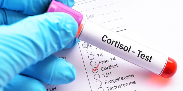 cortizol, nivel de cortizol, analize necesare pentru testarea cortizolului, 
