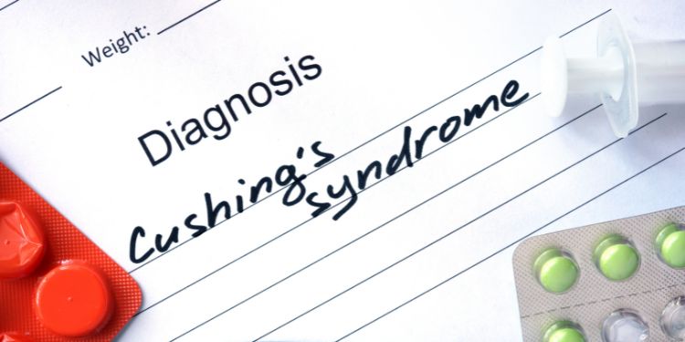 diagnostic cortizol marit, cum previi cortizolul marit, simptome sindromul Cushing, sindromul Cushing diagnostic, cum se trateaza sindromul Cushing