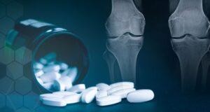 Suplimente pentru articulații