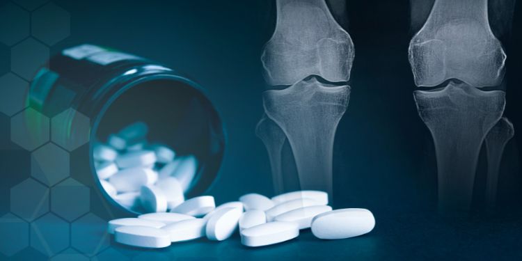 Suplimente pentru articulații