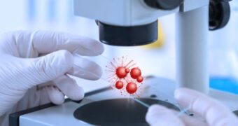 Imunoterapia antrenează sistemul imunitar să elimine tomorile