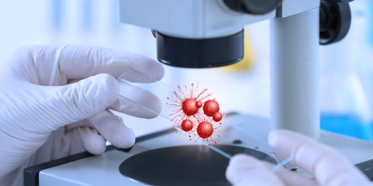 Imunoterapia antrenează sistemul imunitar să elimine tomorile
