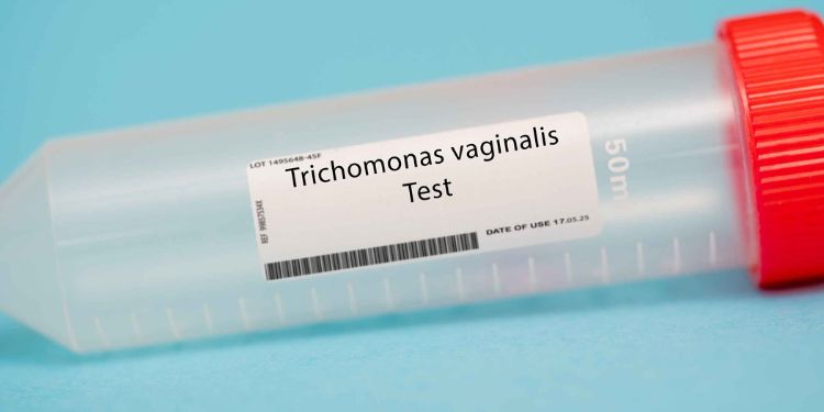 tipuri de infectii genitale la femei, Trichomonas vaginalis,