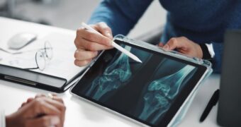 Osteoporoza. Cauze. Simptome. Diagnostic și tratament. Complicații posibile