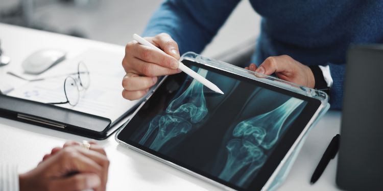 Osteoporoza. Cauze. Simptome. Diagnostic și tratament. Complicații posibile