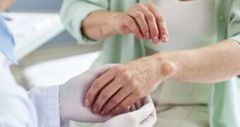 Ce analize se fac pentru psoriazis. Ghid complet de diagnostic