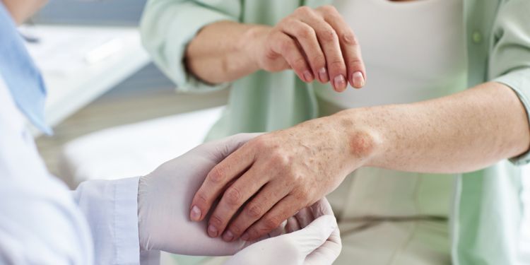 Ce analize se fac pentru psoriazis. Ghid complet de diagnostic