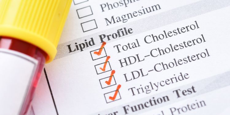 ce contine un set complet de analize, hemoleucograma completa, profilul lipidic, profilul funcțional hepatic,