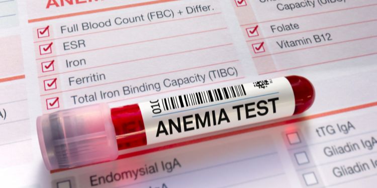 analize anemie, analize de laborator pentru anemie, de ce apare anemia,