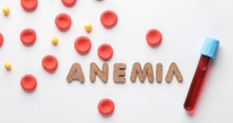 Anemie. Analize de laborator pentru diagnostic