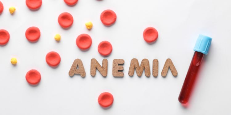 Anemie. Analize de laborator pentru diagnostic