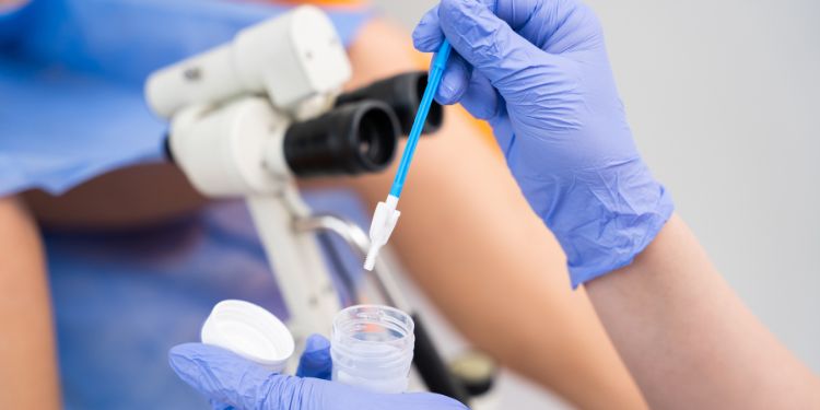 cum se face colposcopia, colposcopia se face cu anestezie, se poate face colposcopie cu biopsie, ce trebuie sa fac inainte de colposcopie,