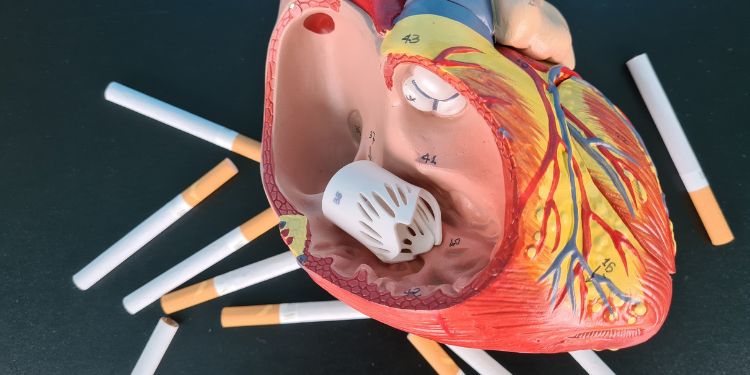infarct miocardic, atac de cord