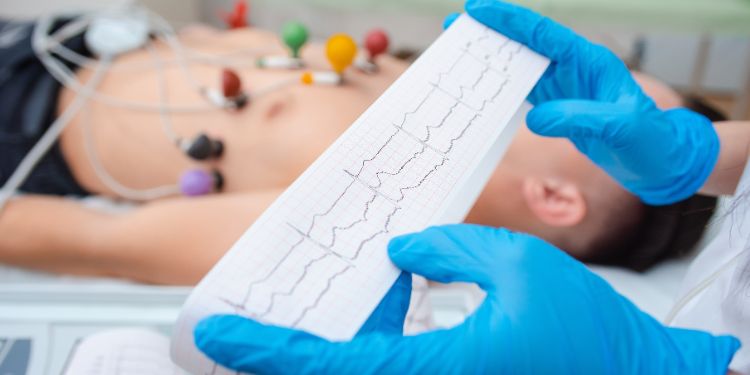 infarct miocardic, atac de cord, EKG,