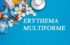 Eritem multiform. Cauze, simptome, tratament și sfaturi medicale