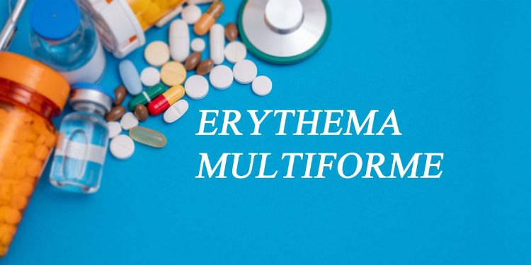 Eritem multiform. Cauze, simptome, tratament și sfaturi medicale