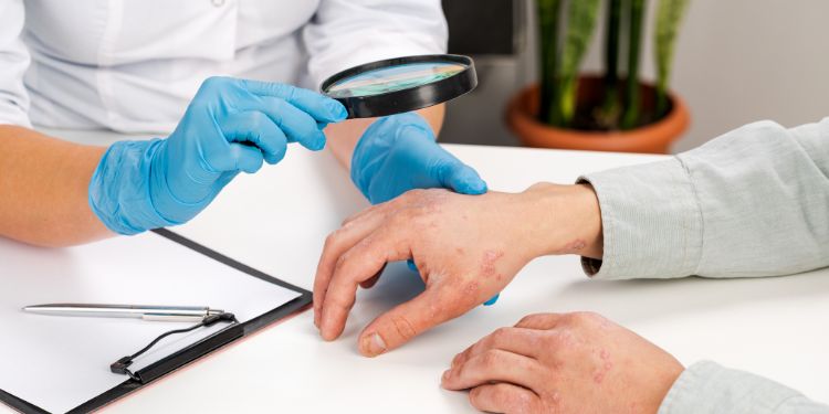 ce analize se fac pentru psoriazis, ghid complet de diagnostic pentru psoriazis, analizele de laborator pentru psoriazis, biopsia pentru psoriazis, investigatii pentru artrita psoriazica, 