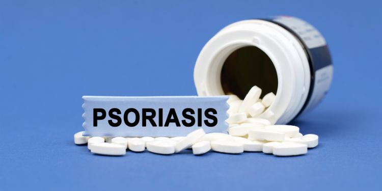 monitorizarea tratamentului in psoriazis, 
