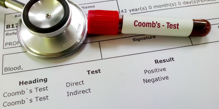 test Coombs direct rezultate, test Coombs direct transfuzii, test Coombs direct pozitiv, test Coombs direct negativ,