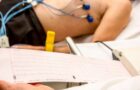 Electrocardiograma (EKG) – când se face și ce înseamnă rezultatele