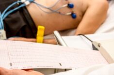 Electrocardiograma (EKG) – când se face și ce înseamnă rezultatele
