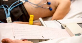 Electrocardiograma (EKG) – când se face și ce înseamnă rezultatele