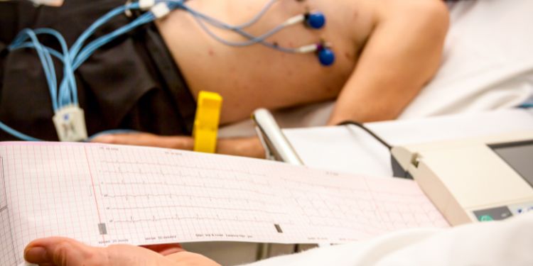 Electrocardiograma (EKG) – când se face și ce înseamnă rezultatele