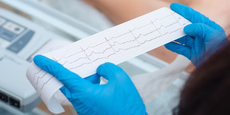 semne ca aveti nevoie de o electrocardiograma,