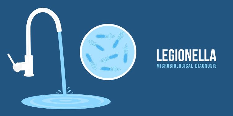ce boli provoaca infectia cu Legionella, infectia cu Legionella simptomele, febra Pontiac, infectia cu Legionella boala legionarilor,