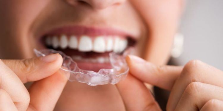 (P) Ce probleme poate corecta un aparat dentar și când este recomandat consultul ortodontic?