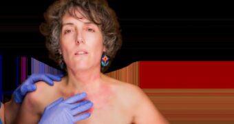 Eczema: tipuri, cauze, manifestări clinice și soluții