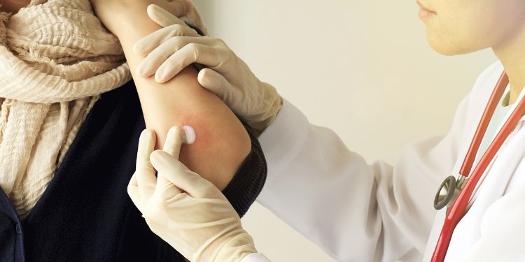 ce este eczema, tipuri de eczema, de ce apare eczema, ce poate declansa un puseu de eczema, cauze eczema, simptome eczema, cum este diagnosticata eczema, ce solutii exista pentru eczema, tratament eczema, cum reduci riscul unor noi episoade de eczema, eczema cand trebuie sa mergi la dermatolog,