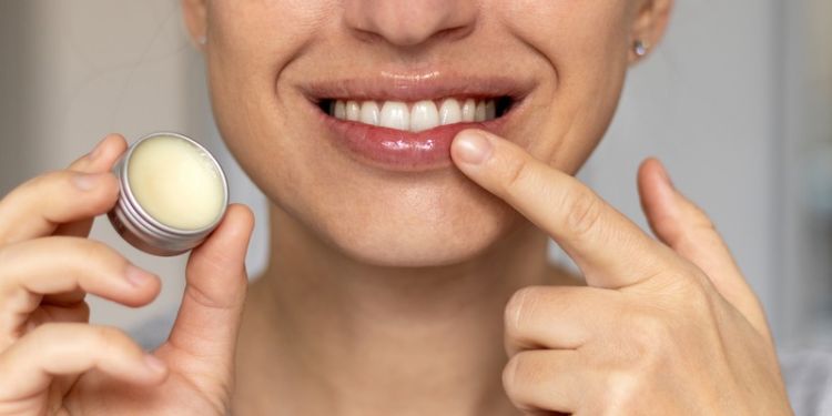 cheilita angulara complicatii, sfaturi pentru a preveni cheilita angulara,