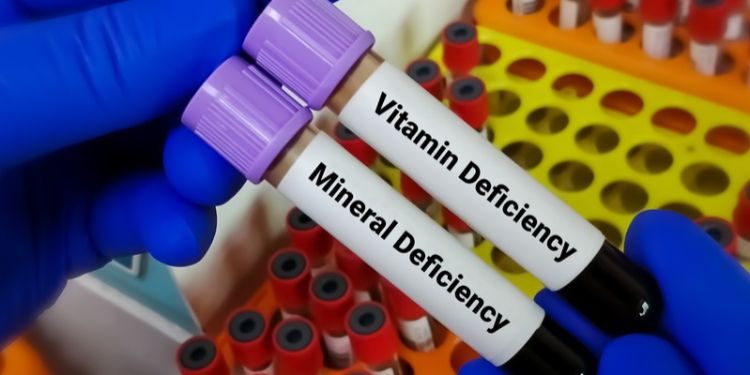 cheilita angulara deficiente de vitamine si minera, bolile si tratamentele care cresc riscul de cheilita angulara,
